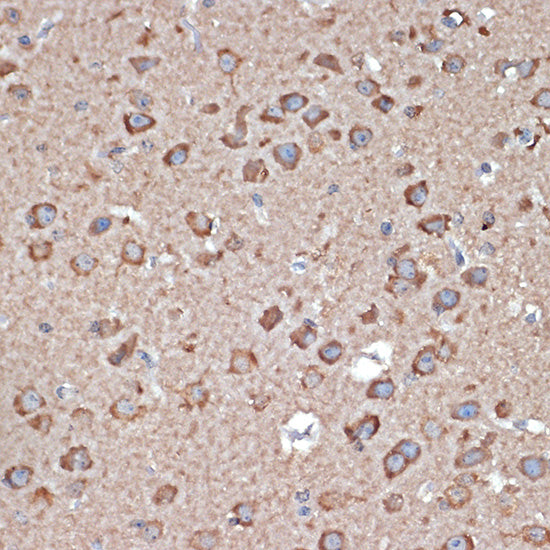 GluR1/GRIA1 Rabbit pAb