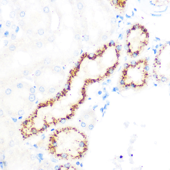 OSR1 Rabbit pAb