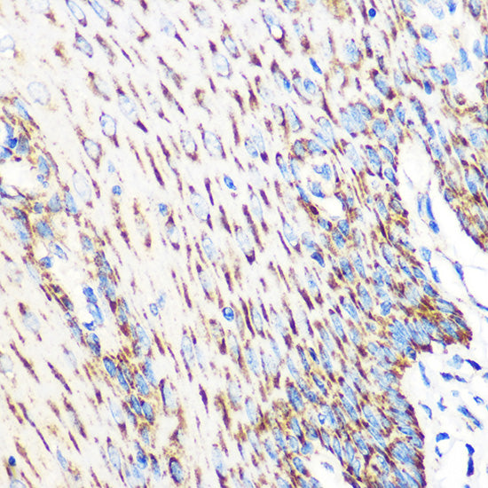 OSR1 Rabbit pAb