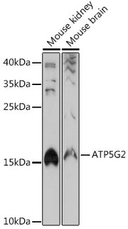 ATP5G2 Rabbit pAb