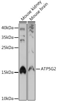 ATP5G2 Rabbit pAb
