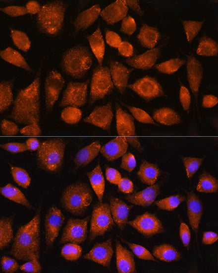 ATP5G2 Rabbit pAb