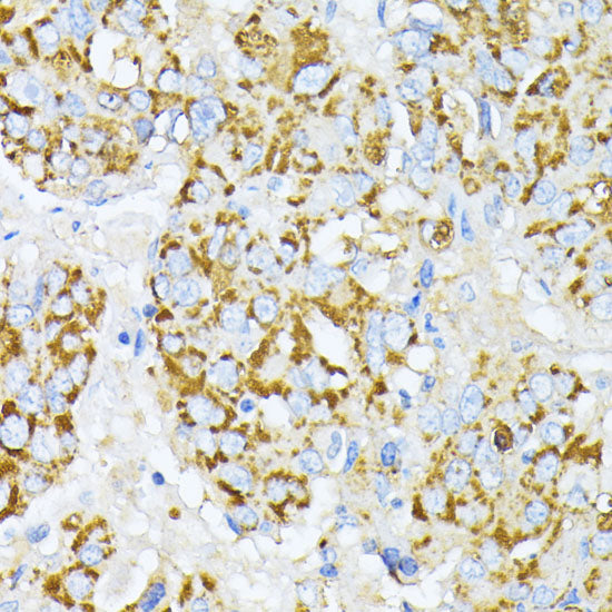 Peroxiredoxin 4 (PRDX4) Rabbit pAb
