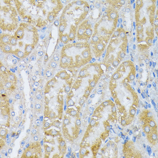 Peroxiredoxin 4 (PRDX4) Rabbit pAb