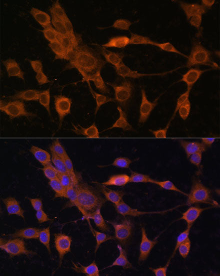 Peroxiredoxin 4 (PRDX4) Rabbit pAb