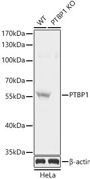 [KO Validated] PTBP1 Rabbit pAb