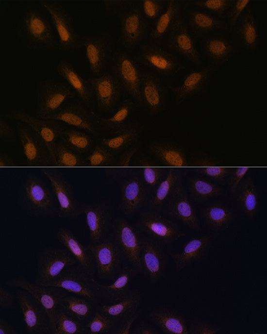 DNA polymerase eta Rabbit pAb