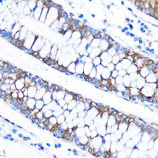 CABP1 Rabbit pAb