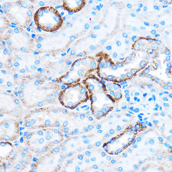 CABP1 Rabbit pAb