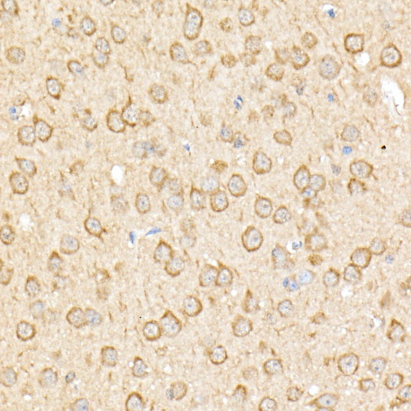 RPGR Rabbit pAb