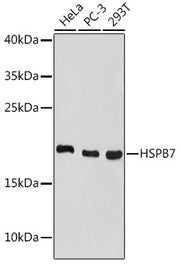 HSPB7 Rabbit pAb