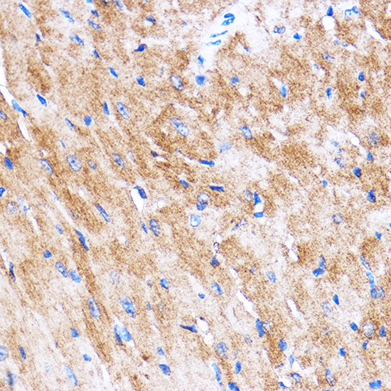 HSPB7 Rabbit pAb