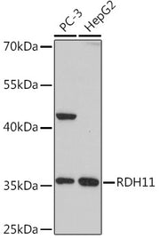 RDH11 Rabbit pAb