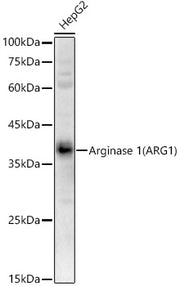 Arginase 1 (ARG1) Rabbit pAb