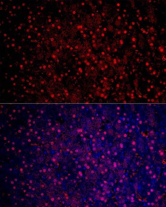 Arginase 1 (ARG1) Rabbit pAb