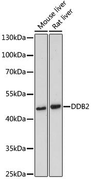 DDB2 Rabbit pAb