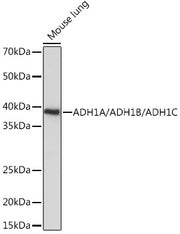 ADH1A/ADH1B/ADH1C Rabbit pAb