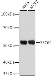 SEC62 Rabbit pAb