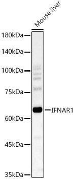 IFNAR1 Rabbit pAb