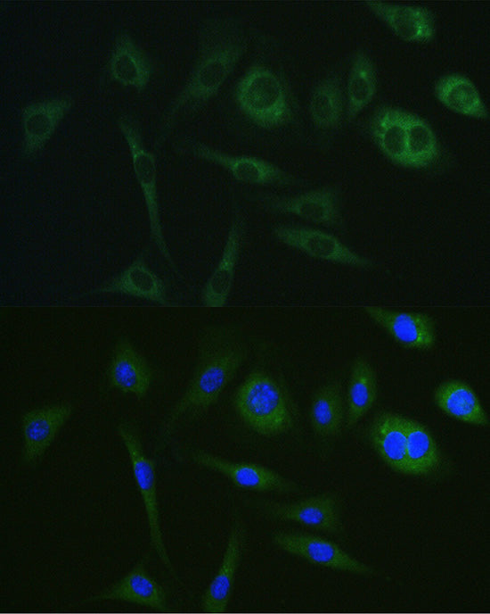 [KD Validated] PKA C-alpha (PRKACA) Mouse mAb