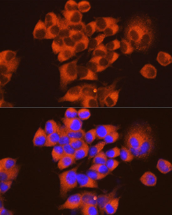 [KD Validated] PKA C-alpha (PRKACA) Mouse mAb