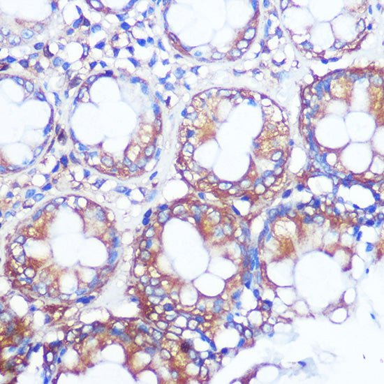 Collagen X/COL10A1 Rabbit pAb