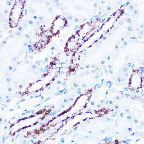 ASB3 Rabbit pAb