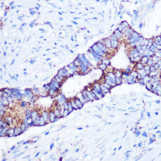 ASB3 Rabbit pAb