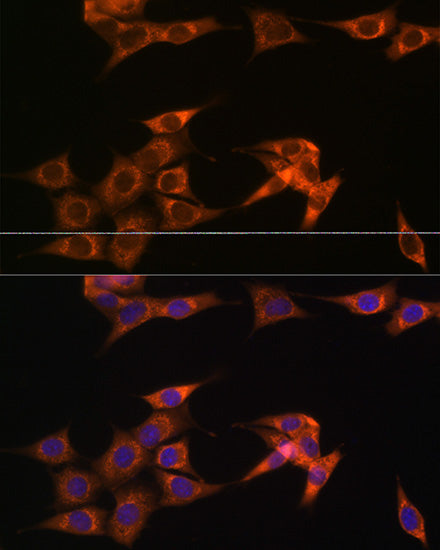 ASB3 Rabbit pAb