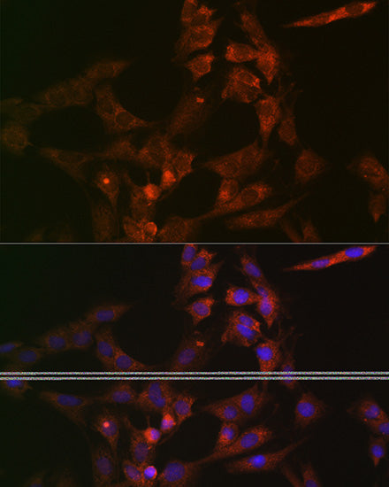 ASB3 Rabbit pAb