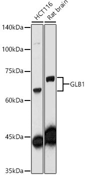 GLB1 Rabbit pAb