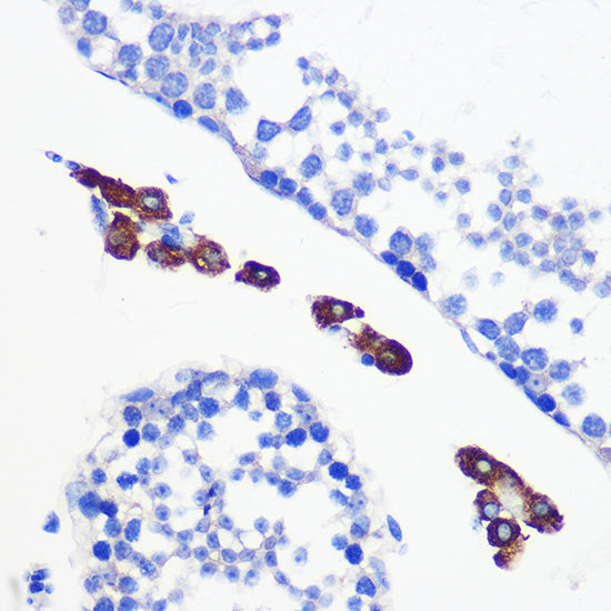 [KO Validated] Bax Rabbit mAb
