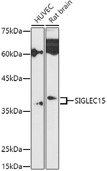 Siglec-15 Rabbit pAb