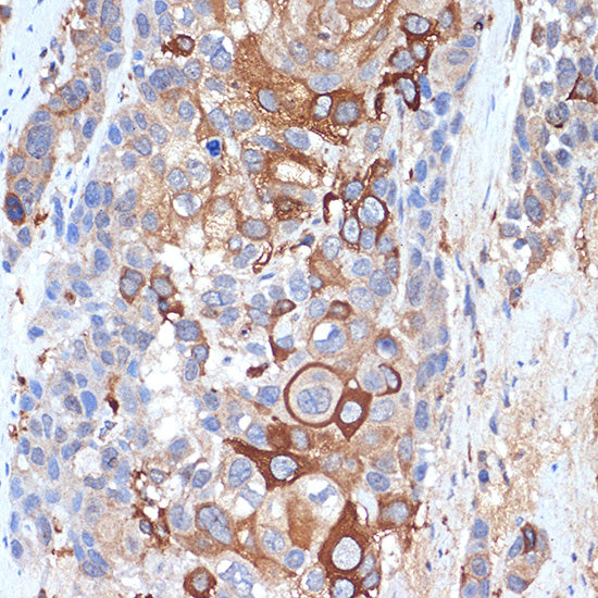 Siglec-15 Rabbit pAb