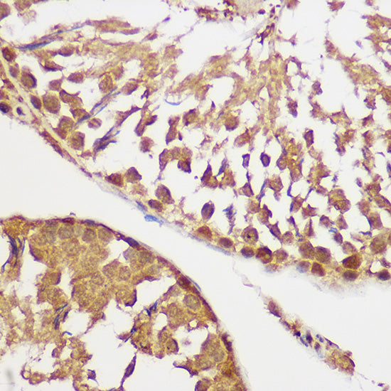 Pan-Akt Rabbit mAb