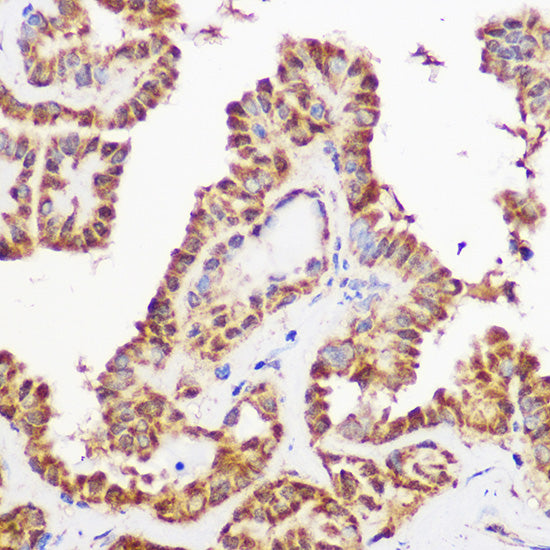 Pan-Akt Rabbit mAb