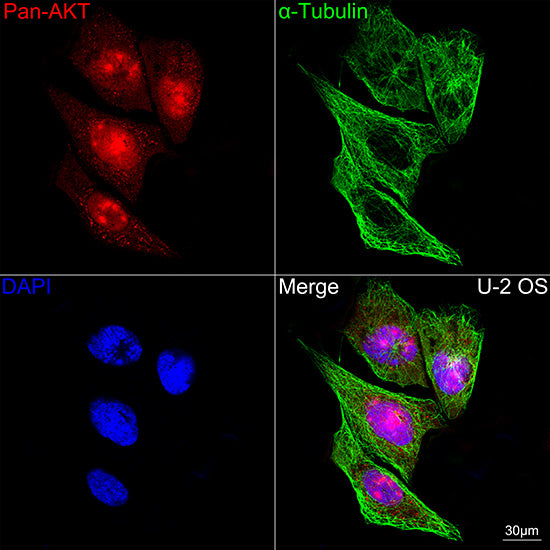 Pan-Akt Rabbit mAb