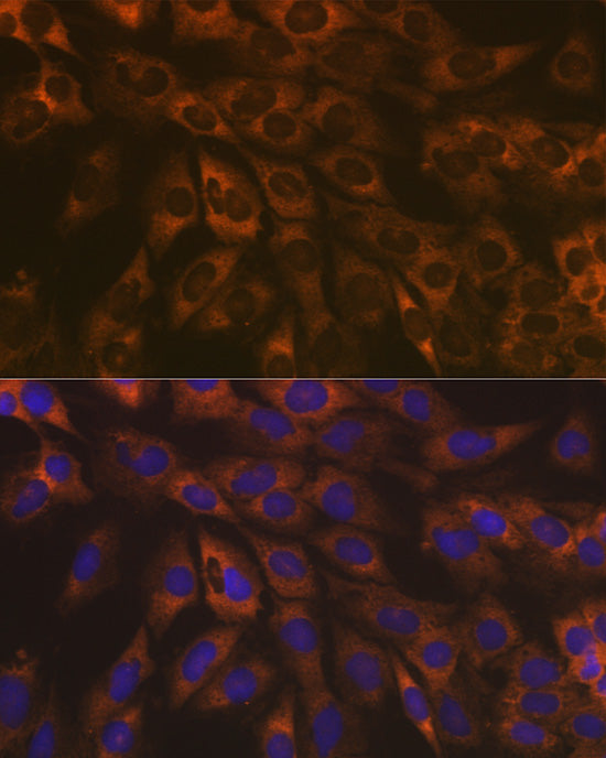 [KO Validated] Caspase-9 Rabbit mAb
