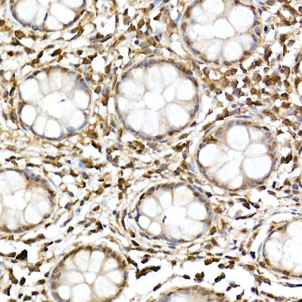 JNK1/2/3 Rabbit pAb