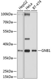 GNB1 Rabbit pAb