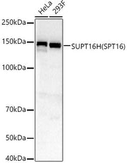 SUPT16H (SPT16) Rabbit pAb