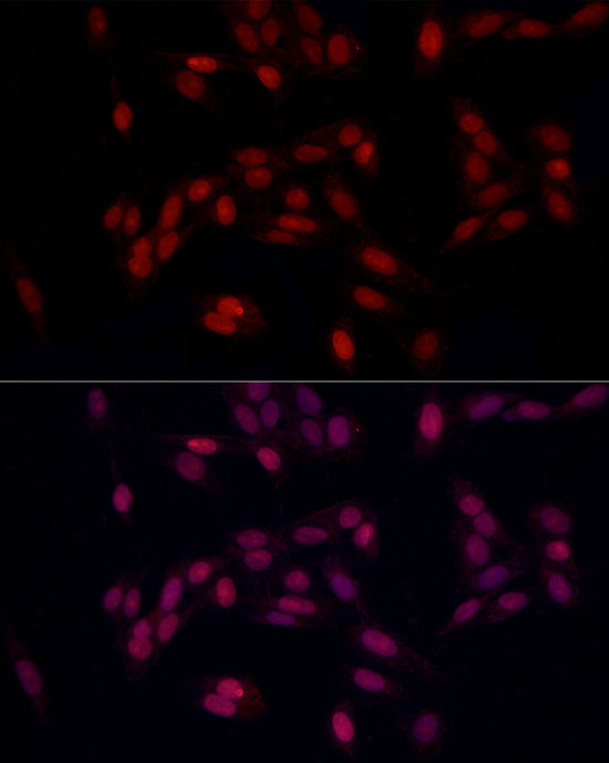 SUPT16H (SPT16) Rabbit pAb