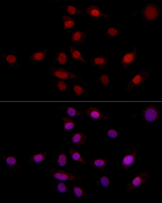 SUPT16H (SPT16) Rabbit pAb
