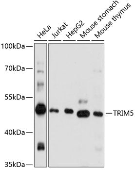 TRIM5 Rabbit pAb