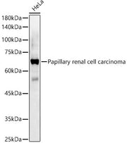 Papillary renal cell carcinoma Rabbit pAb
