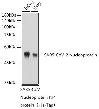 SARS-CoV-2 Nucleoprotein Rabbit pAb