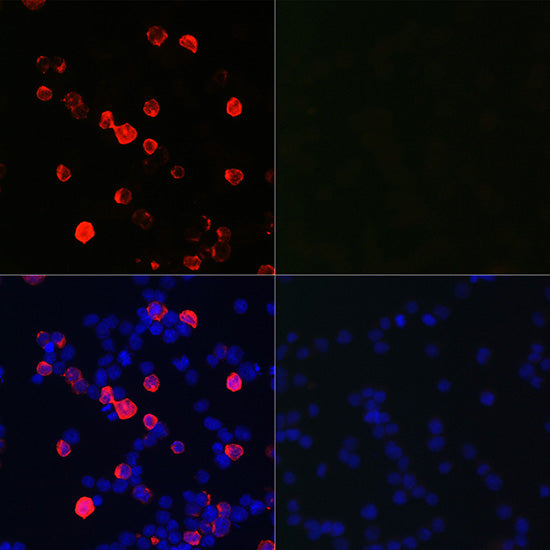 SARS-CoV-2 Nucleoprotein Rabbit pAb