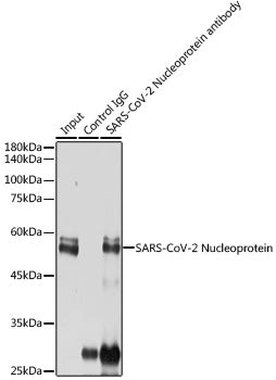SARS-CoV-2 Nucleoprotein Rabbit pAb