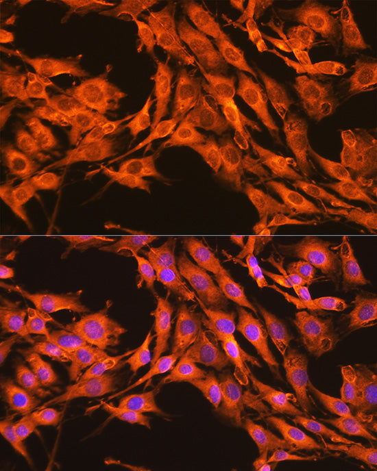 PKM2-specific Rabbit pAb