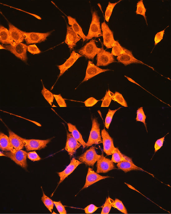 PKM2-specific Rabbit pAb